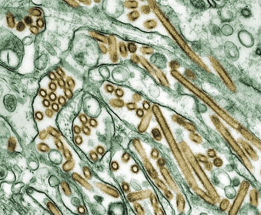 Electron Micrograph of Avian Influenza A H5N1 viruses (2013) Cynthia Goldsmith | Wikimedia Commons
